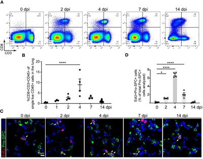 CD8 T cell response and its released cytokine IFN-γ are necessary for lung alveolar epithelial repair during bacterial pneumonia